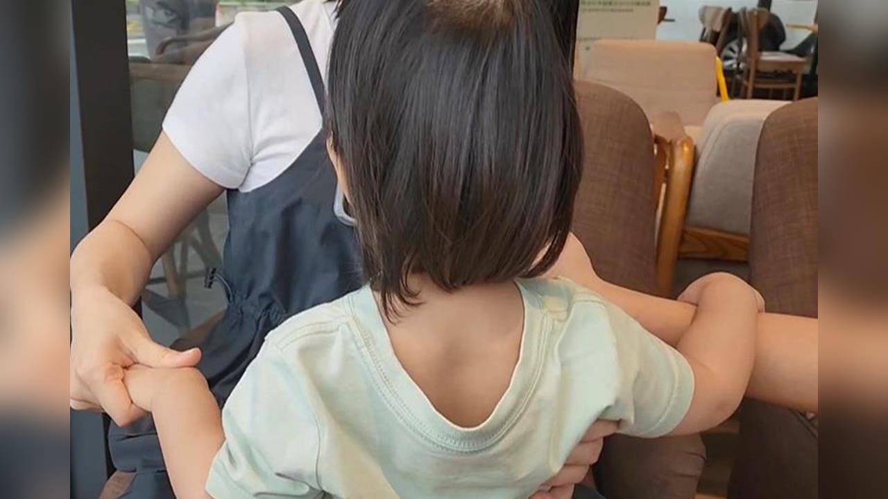 女嬰腦傷歷經五次開顱 父母控保母涉及凌虐 檢不起訴