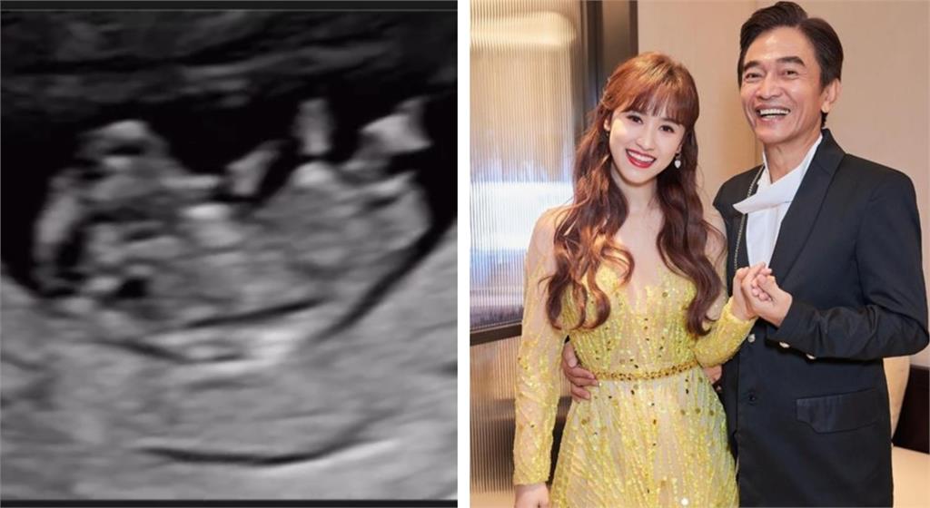 吳姍儒宣布懷孕5個月！吳宗憲「鬆口曝預產期」：公的母的都非常開心