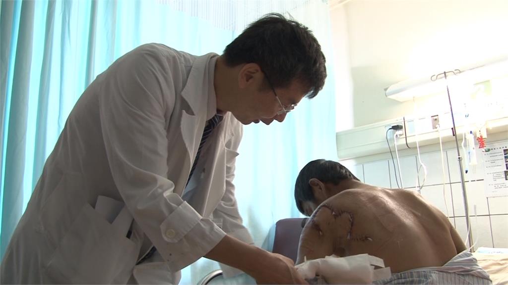 超級細菌難檢測!全球每年多達600萬人死於嚴重感染