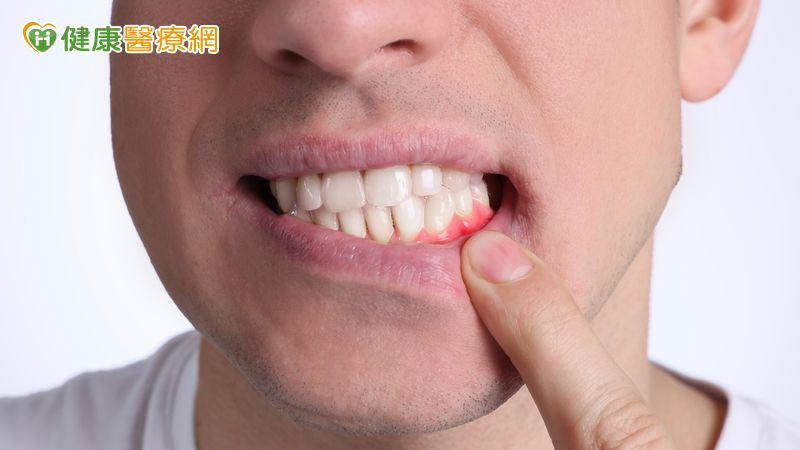 加國病人牙齦萎縮影響進食來台求醫 「新式微創」助解決多年口腔困擾