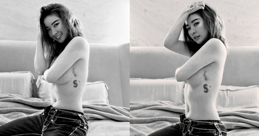 婦女節首曬「術後疤痕照」　許維恩堅強喊：每一道都是人生勳章