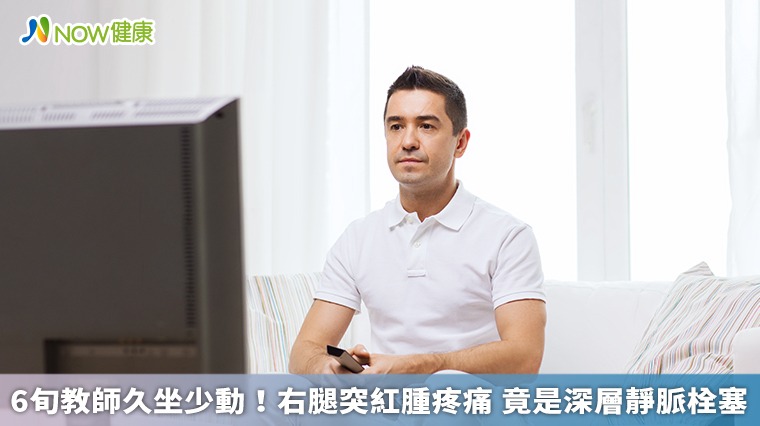 6旬教師久坐少動！右腿突紅腫疼痛 竟是深層靜脈栓塞