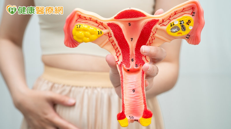 女性常見「多囊」改名了!PCOS更名PMOS 醫揭「P、M、O各代表什麼」