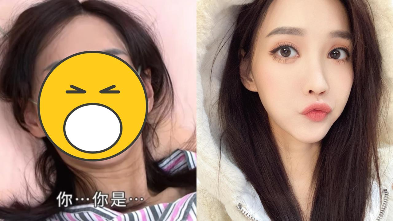 八點檔女神「車禍毀容」花500萬重塑！徐千京223字吐心聲：手術逾10次…