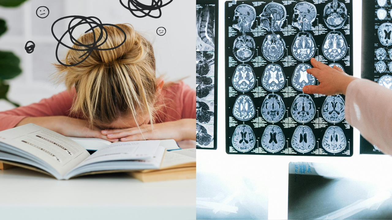 失智與「人格特質」有關?專家點名「這類人」壓力爆棚恐增老化風險