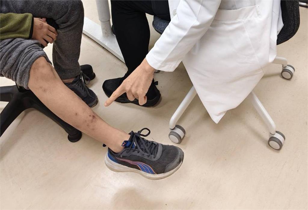 注意！今年「掃墓病」已爆25例   發燒+神祕焦痂就是大警訊