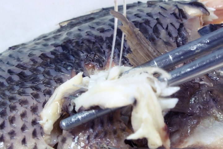 1公分魚刺穿破腸道 12歲童險喪命