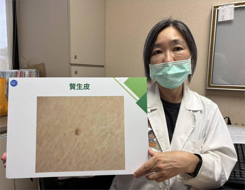 熟女三角地帶「凸一塊」天天磨到劇痛！   原來贅生皮作怪