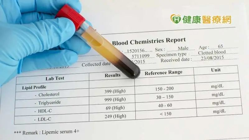 壯世代定期健檢關心自身健康！應做哪些健檢項目？健檢報告怎麼看？