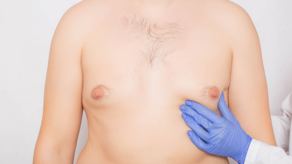 猛健樂瘦身仍甩不掉「肥仔波」？醫揭男性女乳症頑固真相