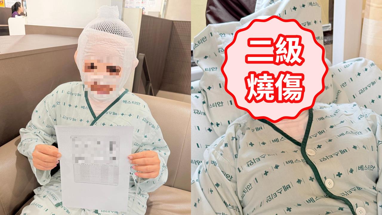 男子怕被戴綠帽趁妻熟睡「拿煮沸熱水倒臉」!老婆毀容PO網求救驚人傷勢曝