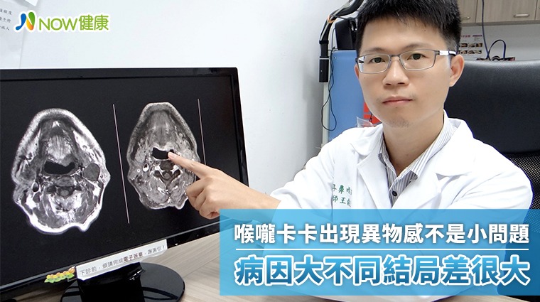 喉嚨卡卡出現異物感不是小問題 病因大不同結局差很大