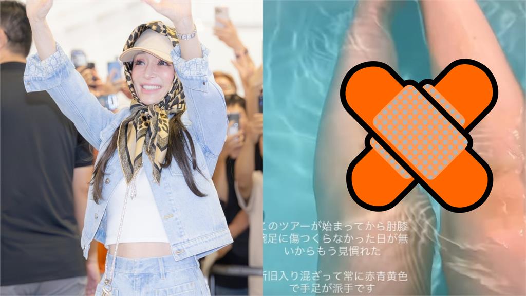 日本流行天后濱崎步睽違17年抵台 親曬「超赤裸入浴照」驚見小腿全是傷!