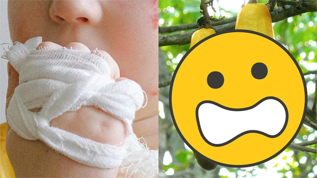 他大嗑「神秘水果」竟火燒嘴唇！超慘釀三級灼傷「毀容原因」曝光