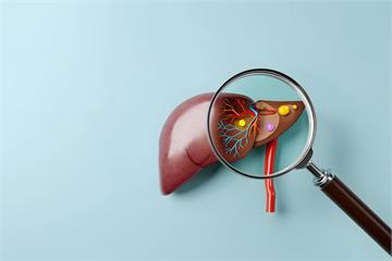 脂肪肝可以好嗎？營養師揭「8大類」護肝食物、「5招」遠離脂肪肝