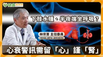 心衰竭不只是「心臟變弱」　醫揭第三代礦物性皮質素受體抑制劑的臨床治療定位