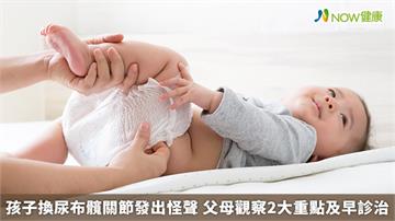 孩子換尿布髖關節發出怪聲 父母觀察2大重點及早診治