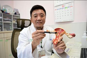 子宮內膜癌年輕化「不到40歲已近1成」   異常出血2症狀別鐵齒