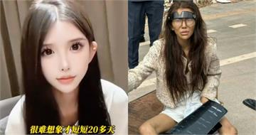被男友騙去柬埔寨！女網紅骨折流落街頭　「正妹變瘋癲大媽」超驚人