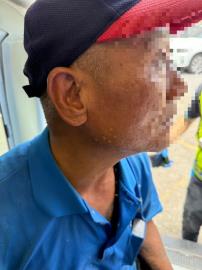 竹南科工廠外包工人遭鹼性廢液噴濺　3傷送醫