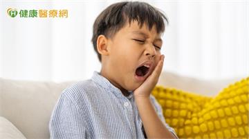5歲童蛀牙竟變蜂窩性組織炎　醫：吃飯太久蛀牙風險增3倍