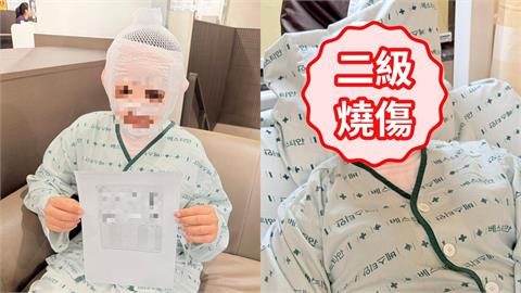 男子怕被戴綠帽趁妻熟睡「拿煮沸熱水倒臉」!老婆毀容PO網求救驚人傷勢曝
