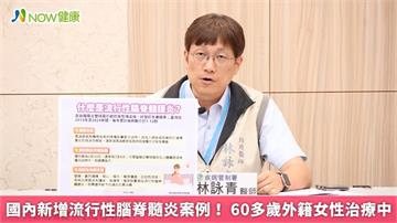 國內新增流行性腦脊髓炎案例! 60多歲外籍女性治療中