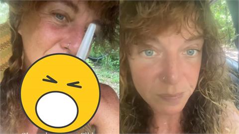 44歲女激推「尿療法」每天喝、擦皮膚可回春？醫師急示警：恐造成腎臟受損