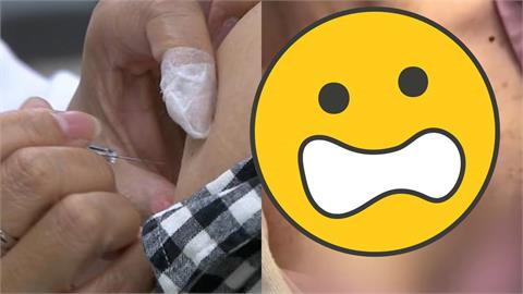 健身妹「注射1針」體態粗勇進化！這部位「驚見凸起物」專家一驗：獸用藥