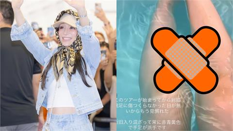 日本流行天后濱崎步睽違17年抵台　親曬「超赤裸入浴照」驚見小腿全是傷！