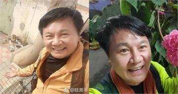 眭澔平被爆性騷整骨師！要求「按摩鼠蹊部」一臉享受　受害者痛批噁心