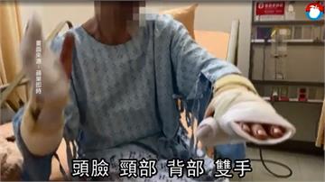 債務糾紛遭砍傷！男子控員警「冷眼旁觀」