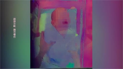 月中護理師頻粗魯抱嬰疑害罹「搖晃症」　議員轟踐踏家長信任