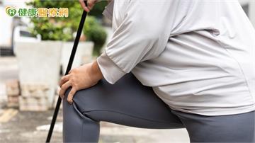 體重101公斤、膝痛3年！63歲婦一度要換人工關節　醫建議：先處理體重