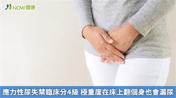 應力性尿失禁臨床分4級 極重度在床上翻個身也會漏尿