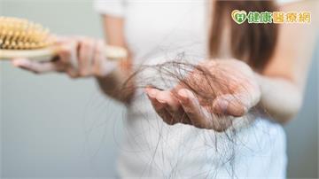 洗頭頭髮掉滿地？　專家解析「女性常見掉髮類型與對策」一次看懂
