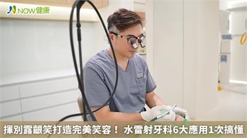 揮別露齦笑打造完美笑容！ 水雷射牙科6大應用1次搞懂