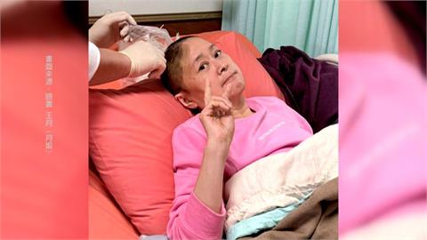 60歲王月暈倒撞頭 緊急開顱昏迷5天"頭蓋骨少一部份"
