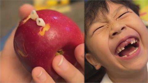 啃蘋果掉下「2顆牙齒」？6歲男童沒門牙燦笑影片曝光　網揭2點轟擺拍