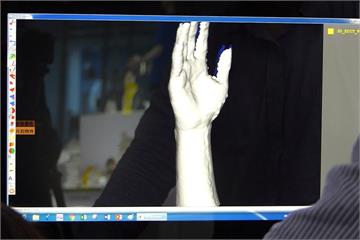 3D列印製作義肢  掃描到製成僅需6小時