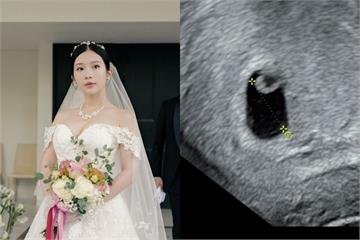 鄭家純懷孕9週不幸流產　發聲反對代理孕母合法化