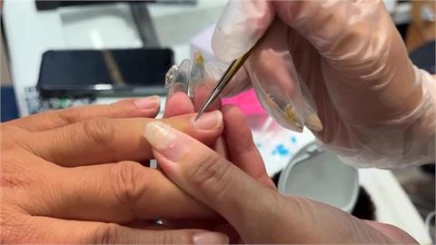 指甲易斷、有紋路竟是「身體的3大警訊」？醫曝補救「必吃菜單」