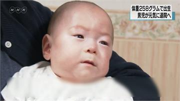 世界最小新生兒！日本258克「巴掌仙子」長大出院