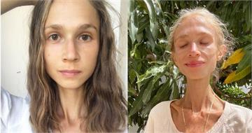 超極端素食者！27歲女只吃水果瘦成22kg紙片人　出國玩竟活活餓死