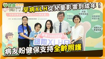 1歲有症狀、22歲才確診！罕病XLH病友盼健保支持全齡照護