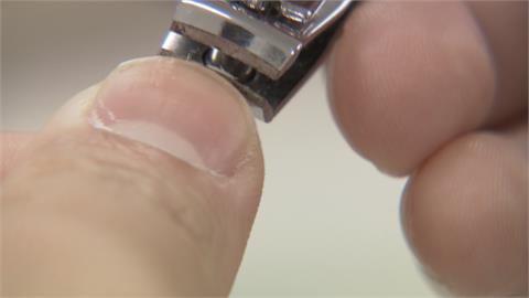 獨家／奇！人指甲竟是中藥材　中醫師：有此藥但別亂吃