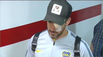 球迷攻擊巴士球員受傷  南美職足決賽延後