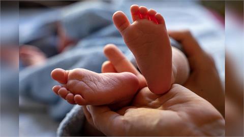 女嬰罹罕病色素失調症  醫籲早期診療仍能健康成長