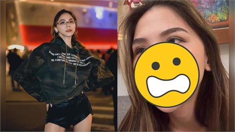 蕾菈遭突襲「半張臉被抓傷」險毀容！竟是「1片段惹事」驚悚過程曝：好扯…