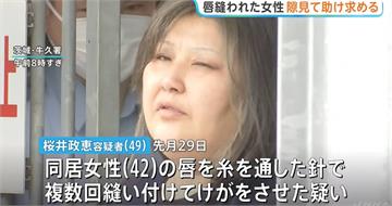 嘴唇被同居人用針線縫死！　日女逃到超商靠紙條「請救救我」求救